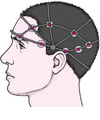 30 segundos para morir az movies. Trastornos Convulsivos Enfermedades Cerebrales Medulares Y Nerviosas Manual Msd Version Para Publico General