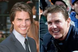 Find out which plastic surgery procedures are performed most often. Celebrity Face Transformations From Tom Cruise To Madonna