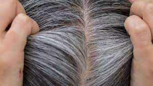 Due to white hair we look old in young age.well their are many product available in the market, which turn your white hair into black.many times these product & many times it gives you side effects. Top Grey Hair Treatment To Prevent White Hair From Spreading