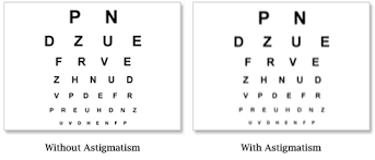 Astigmatism Eyepedia
