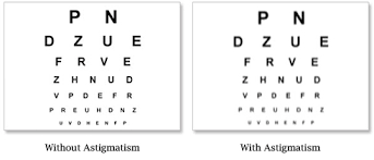 astigmatism eyepedia