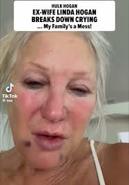 #lindahogan has a breakdown at home crying tears missing her family  #hulkhogan #foryoupage #gossiptwins