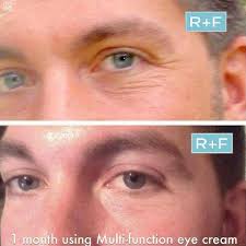 Skin Care Advice For Better Skin Now Multifunction Eye Cream Homemade Eye Cream Eye Cream