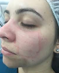 Amílcar Dermatology