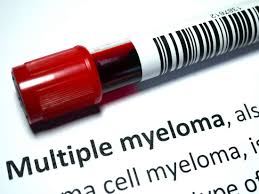 What Are The Signs Of Multiple Myeloma Symptoms And Diagnosis