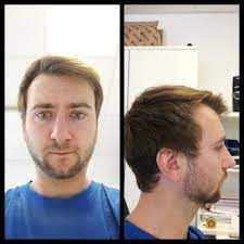 Any Hairstyle Suggestions Receding Hairline Tips Should I Part My Hair Differently Hair Beauty Skin Deals Me Fashi Hair Hairline Celebrity Hair Colors