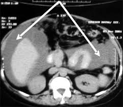 Istorie religie civilizatii tvr romania. Computer Tomograf Tomografie Computerizata Suceava