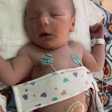 Fundraiser by Kimberly Mortenson : Help Arthur with Tetralogy of Fallot!