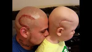 If you have a lot going on in your life right now, you may want to hold off until you have the time to properly care for a new tattoo. Father With Tattoo Of Son S Cancer Scar Wins Bestbalddad Contest Wtol Com