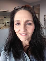 What is up with Patty's hair line !