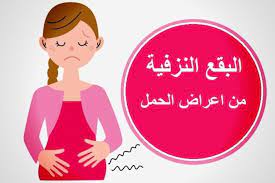 اعراض الحمل المبكرة 18 علامة اكيدة تدل على انك حامل الحمل انسايد