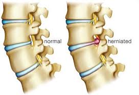 It is the capital and largest city of the autonomous community of catalonia. Lower Back Pain Symptoms Stretches Exercise For Pain Relief