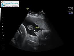 4d ultrasound pictures 36 weeks. 3d Ultrasound Pricing Prenatal Universe Tacoma Wa