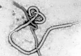 Marburg disease, marburg diagnosis can be confirmed by virus isolation(1,2,4,7), elisa to detect viral antigens or patient. Gesundheit Ebola Und Marburg Virus