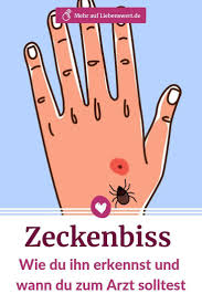 Insektenstiche Erkennen Diese Bilder Helfen Bei Der Zuordnung Insektenstich Zeckenbiss Wespenstich Behandeln