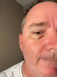 My face after riding all week!