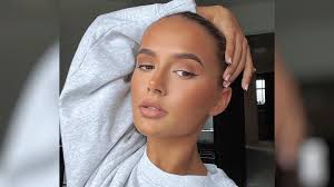 I Have A Full Beard': Molly-Mae's Dermaplaning Experience