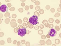 Image result for Basophil Count