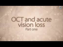 Image result for Acute Vision Loss