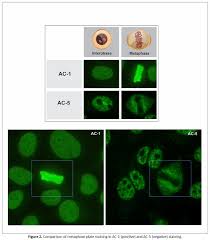 Image result for ANA Staining Pattern
