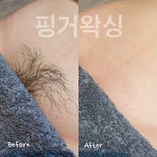 Jan 30, 2019 · 브라질리언 왁싱 부작용은 없을까요? ì¼ì‚° ë¸Œë¼ì§ˆë¦¬ì–¸ ì™ì‹± ì „ë¬¸ì  ê³ ì¿ í•˜ì¿  ìŠˆê°€ë§ ì‹œìˆ í›„ê¸°ì‚¬ì§„