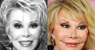 Celebrity Plastic Surgery Disasters Cbs News Infections are rare in plastic surgery, because the patient is usually healthy to begin with. celebrity plastic surgery disasters