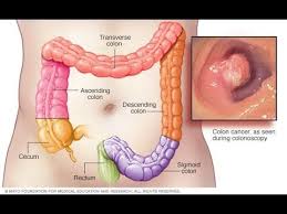 Pin On Maraming Salamat Po Doc Willie Liza Ong