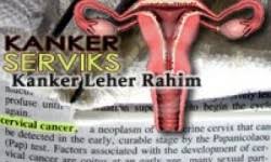 We did not find results for: Topic Yayasan Kanker Indonesia Republika Online