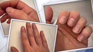We did not find results for: 7 Nail Symptoms And Conditions You Shouldn T Ignore Today