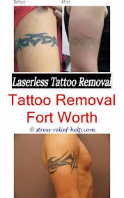 How To Start A Tattoo Removal Business Uk Green Tattoo Removal Can I Get Laser Tattoo Removal While Pregnant Tattoo Tattoo Removal Cost Laser Tattoo Tattoos