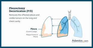 Image result for Pleiotaxis
