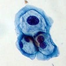 Your doctor will get them within a few days. With Pap Tests Less Common Women May Miss Out On Std Tests Shots Health News Npr