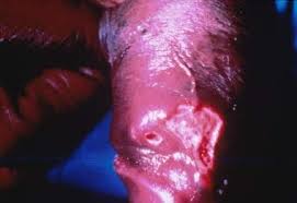 Image result for penis mycosis symptoms