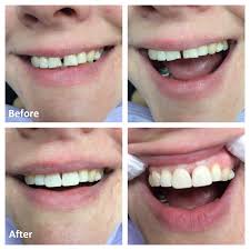 Want to improve your smile? Cosmetic Dentistry Ottawa Rockcliffe Dental Centre