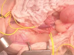 Some stones are tiny and pass through without causing symptoms. Feline Ureteral Obstructions Part 1 Medical Management Clarke 2018 Journal Of Small Animal Practice Wiley Online Library