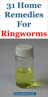 Want to know some specific ways apple cider vinegar can make you healthier? How To Get Rid Of Ringworms 31 Powerful Home Remedies Home Remedies For Ringworm Get Rid Of Ringworm Ringworm Cure