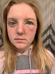 Saying Goodbye to a Beloved Pet Due to Cancer