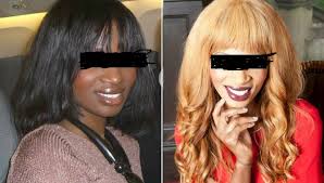 Cameroon: Bleaching is an act of Racial Suicide