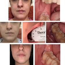 PDF) Can Teledentistry Improve the Monitoring of Patients during the  Covid-19 Dissemination? A Descriptive Pilot Study