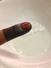 Apa yang korang perlu sediakan adalah mangkuk kecil, serbuk atau cecair clorox, air suam, buah lemon dan krim pelembab atau moisturizer. Whatsapp Image 2018 05 09 At 11 07 34 Pm Mingguan Wanita