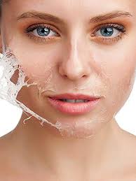 How to stop sunburn peeling. How To Stop Skin From Peeling On Your Face Howstuffworks