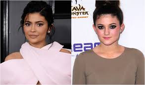 The stigma surrounding plastic surgery is disappearing as more mothers share their experiences, and why surgery was right for them. Kylie Jenner Says She Is Terrified By Plastic Surgery But Admits To Having Injections Wirewag