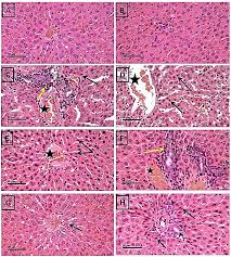 Thymol Protects against 5-Fluorouracil-Induced Hepatotoxicity via the  Regulation of the AktGSK-3β Pathway in In Vivo and In Silico Experimental  Models