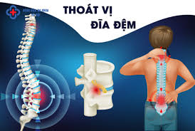 Top 7 căn bệnh xương khớp phổ biến ở người Việt Nam - Bệnh viện đa khoa Hà  Nội
