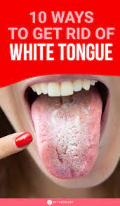 10 Ways To Get Rid Of White Tongue And Make It Healthier In 2021 White Tongue Tongue Sores Tongue Cleaner