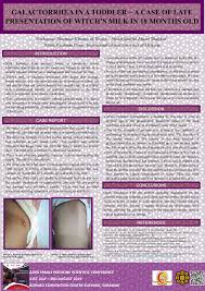 Image result for Galactorrhea