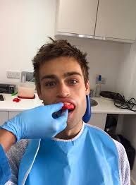 Douglas Booth