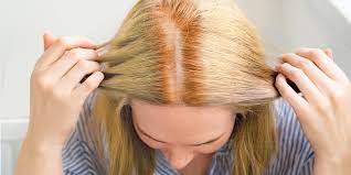 No matter how gentle your hair dye claims to be, there's going to be some sort of damage, breakage and hair fall. How To Fix Hot Roots And Avoid Them Madison Reed