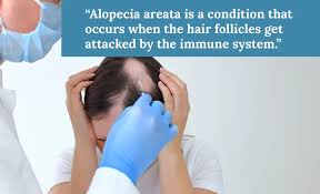 Image result for Hair Pull Test