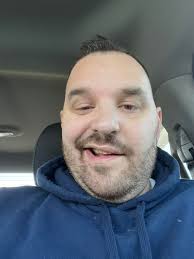 Lil Nas X says he is suffering from a sudden partial paralysis of his face:  "This is me doing a full smile right now by the way."